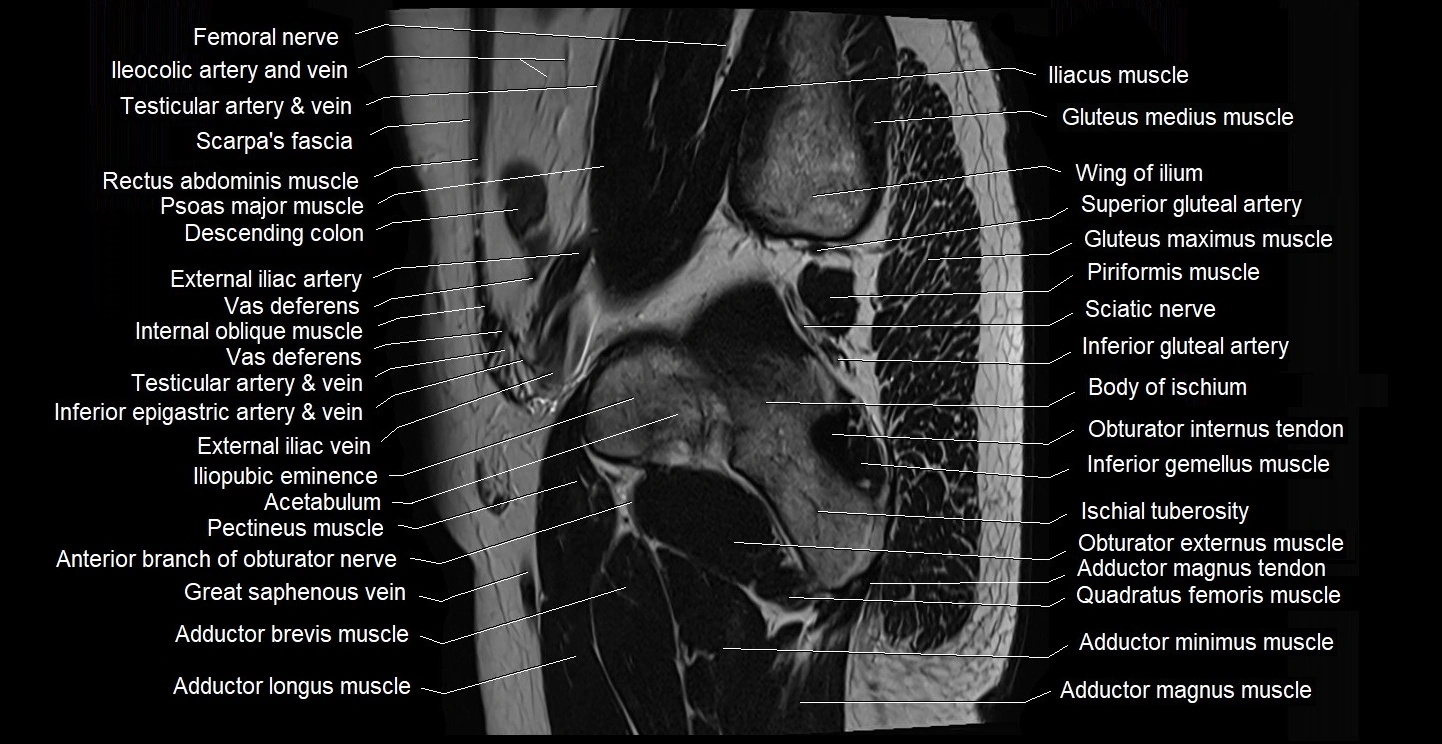 male pelvis sagittal cross sectional anatomy 3T mri image 7.webp